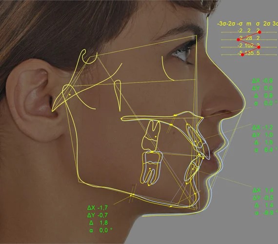 Cephalometric